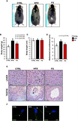 Antioxidants positively regulate obesity dependent circRNAs - sperm quality - functional axis